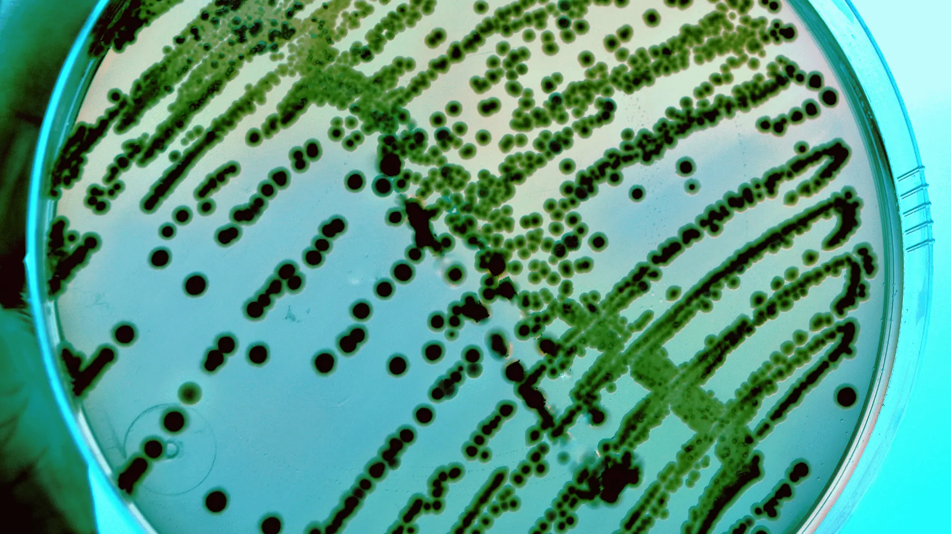 Industrial application of ai in microbiology